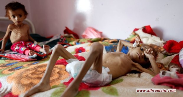 وفاة الطفلة أمل.. الشاهدة على جرائم السعودية في اليمن