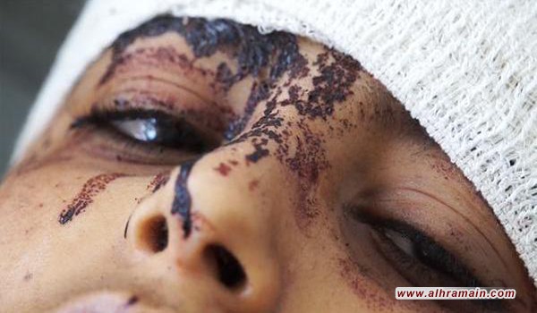بان يطلب من السعودية بيانا بإجراءات التحالف لمنع قتل‭ ‬الأطفال في اليمن
