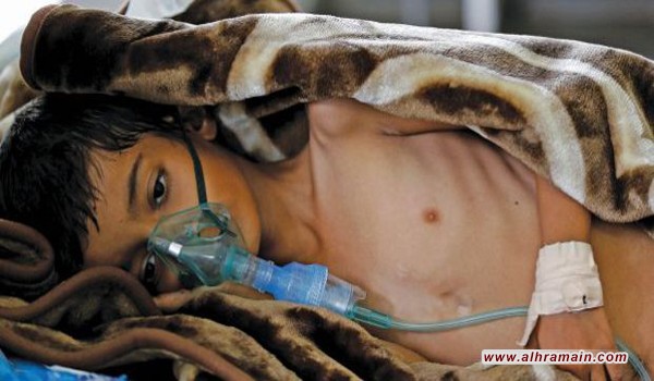 الكوليرا يتحول إلى وباء.. وإعلان حالة الطوارئ في اليمن