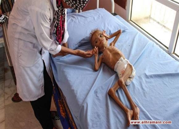 الإندبندنت: مخزون الطعام في اليمن “قد ينفد خلال شهرين”