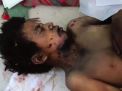50 طفلاً شهيداً بمجزرة العدوان السعودي في صعدة