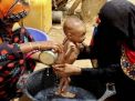 تقرير: طفل يمني يموت كل 10 دقائق بسبب الحصار السعودي