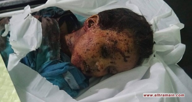 صعدة: استشهاد طفل وإصابة شقيقه بانفجار قنبلة عنقودية سعودية