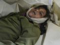 إصابة طفلة بجروح اثر انفجار قنبلة عنقودية من مخلفات العدوان السعودي